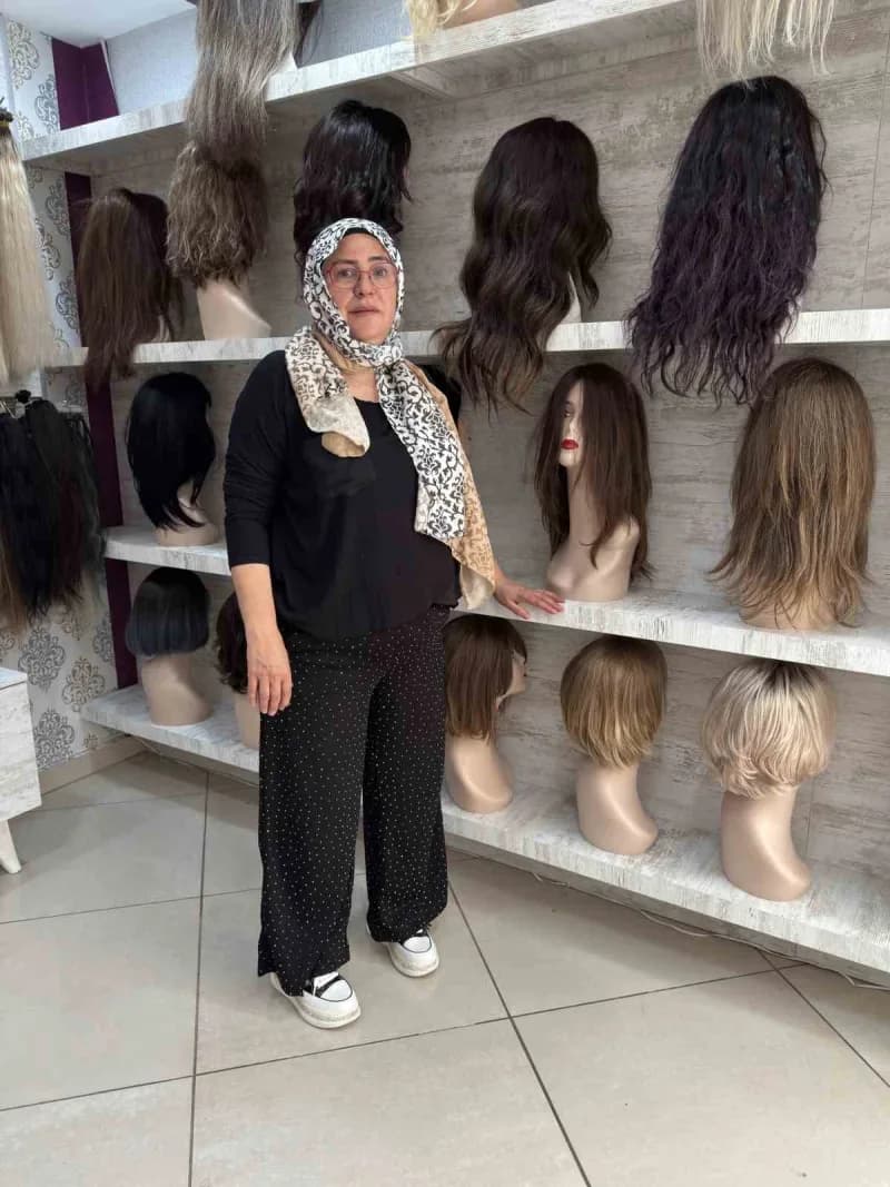 Küçük yaşta geçirdiği korkunç iş kazasında saçlarını ve kulaklarını kaybeden 51 yaşındaki Asiye Koçuk, yaşadığı büyük ac