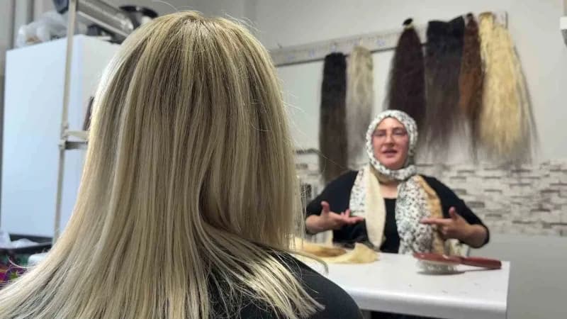 Küçük yaşta geçirdiği korkunç iş kazasında saçlarını ve kulaklarını kaybeden 51 yaşındaki Asiye Koçuk, yaşadığı büyük ac