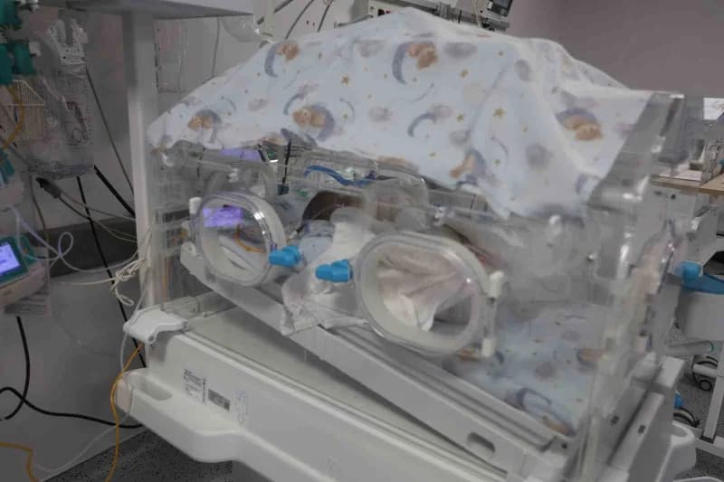 Hatay'da 31 haftalık ve bin 300 gram ağırlığında dünyaya gelen prematüre ikiz bebeklerden birinin bağırsak tıkanıklığı,