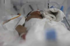 Hatay Defne Devlet Hastanesi’nde bağırsak ameliyatı yapılan Suriyeli prematüre bebek ve ailesi