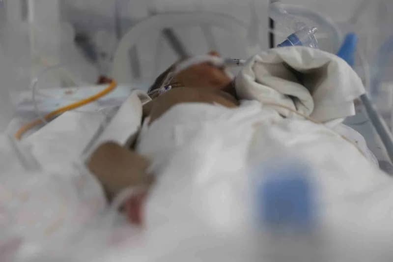 Hatay Defne Devlet Hastanesi’nde bağırsak ameliyatı yapılan Suriyeli prematüre bebek ve ailesi