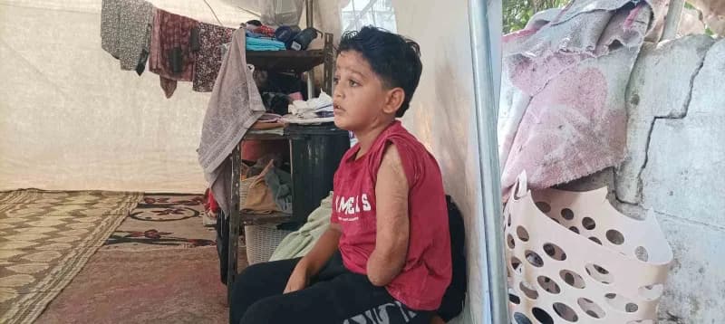 İsrail saldırısında ailesini ve sol kolunu kaybeden 7 yaşındaki Kinan Abu Jabbeh, kendisine artık uymayan proteziyle gün