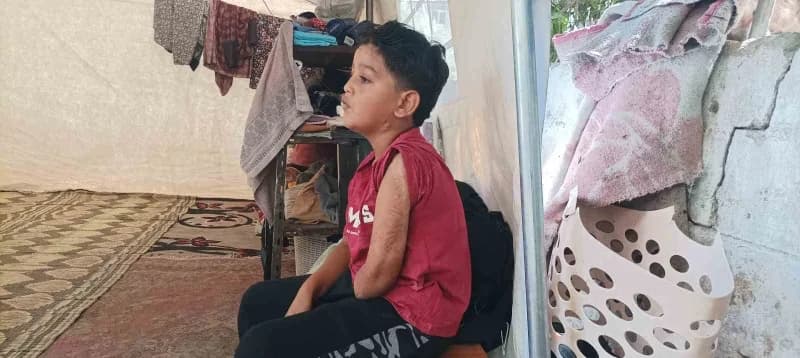 İsrail saldırısında ailesini ve sol kolunu kaybeden 7 yaşındaki Kinan Abu Jabbeh, kendisine artık uymayan proteziyle gün