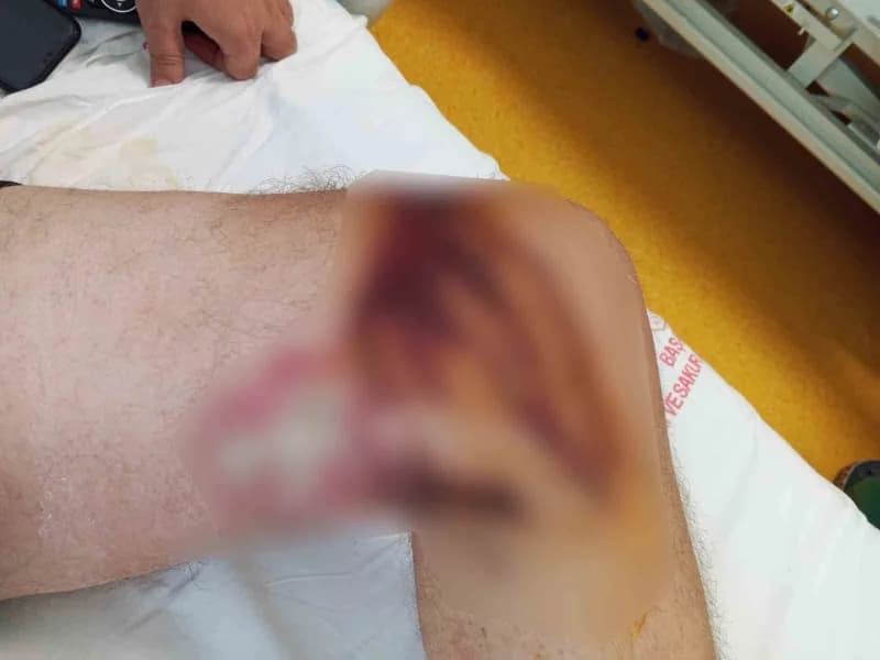 İstanbul'da 46 yaşındaki Ersan Akçil, iddiaya göre nalburdan aldığı lavabo açıcının üzerine dökülmesiyle vücudunun Yakla
