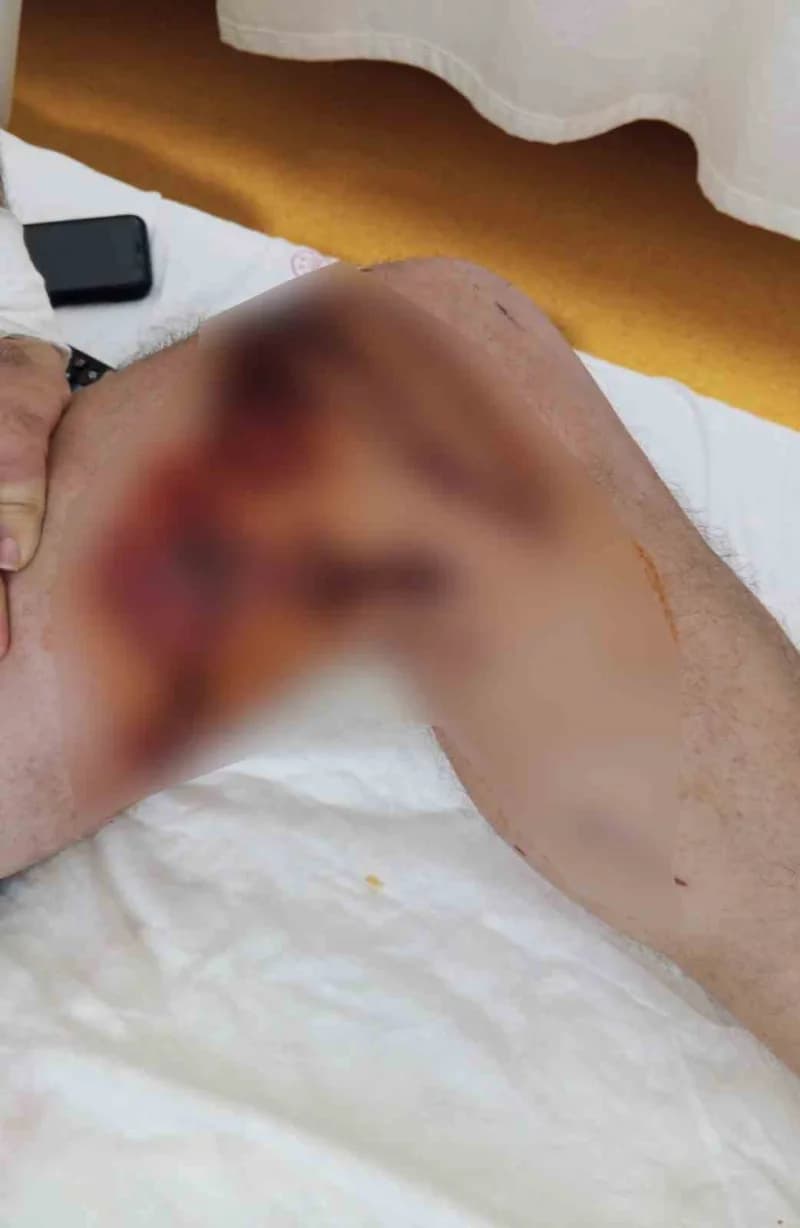 İstanbul'da 46 yaşındaki Ersan Akçil, iddiaya göre nalburdan aldığı lavabo açıcının üzerine dökülmesiyle vücudunun Yakla