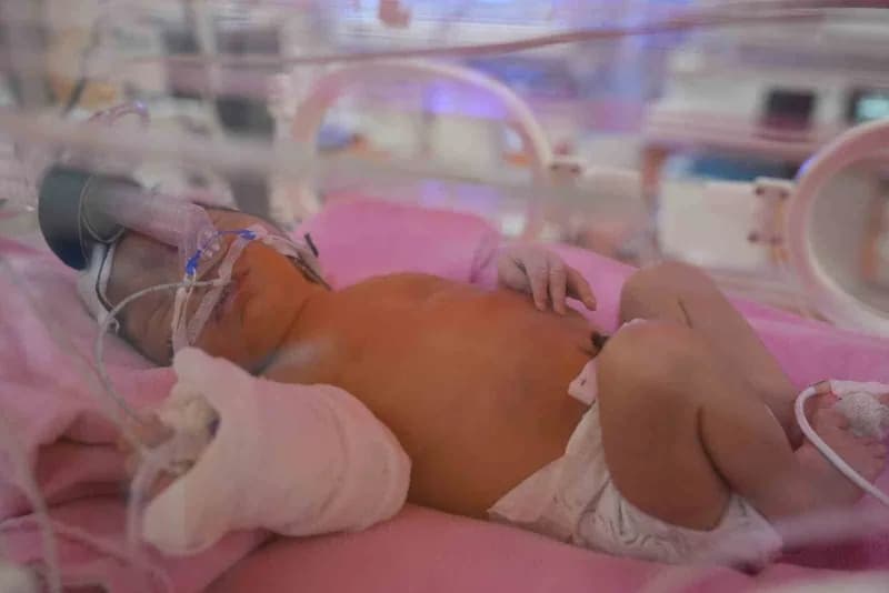 Malatya’da Tüp Bebek ünitesinin ilk bebekleri ikiz oldu