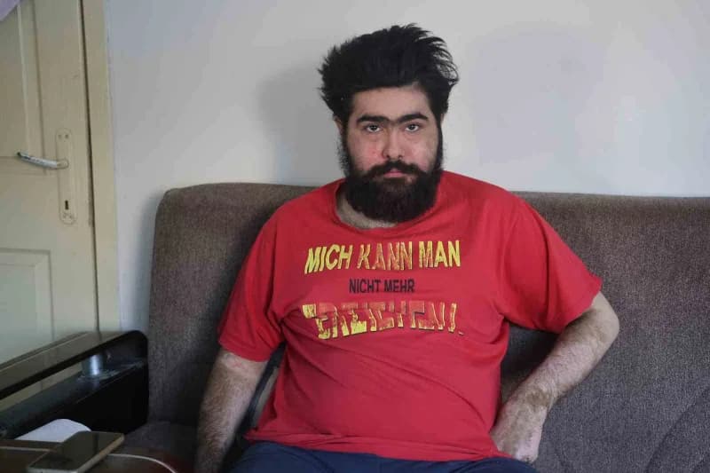 İyi olmak istemediğini ve hayatını düzene sokmak istemediğini ifade eden Özbay, yaklaşık 2 aydan fazla süredir duş almad