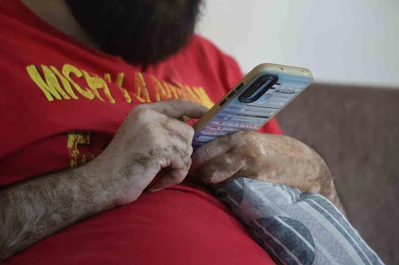 Hatay’da depremin ardından evinden çıkmayarak gününü bilgisayar ve telefonla oynayarak geçiren Barış Özbay, hastanede gö
