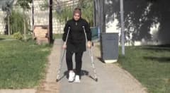 Yanlış ameliyat sonrası bacağı dışa dönen Bahar Ulu yürüyebilmek için destek bekliyor