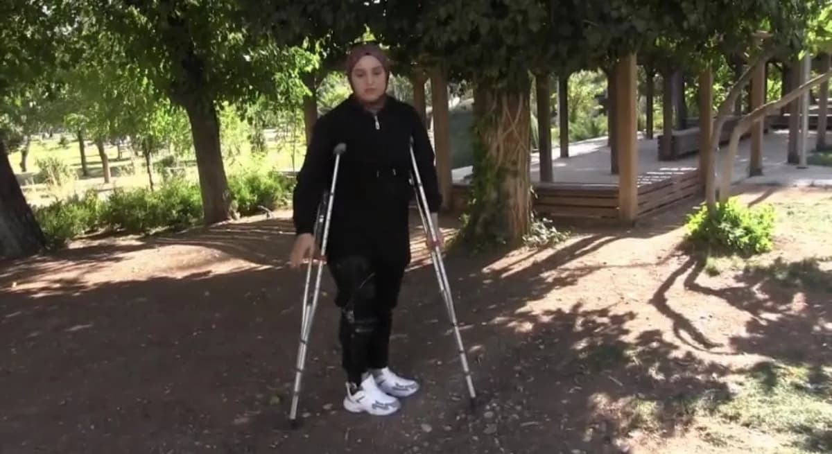 Geçirdiği 10'dan fazla düzeltme ameliyatına rağmen bacağını kullanamayan genç kadın, özgürce adım atabilmek için 71 bin