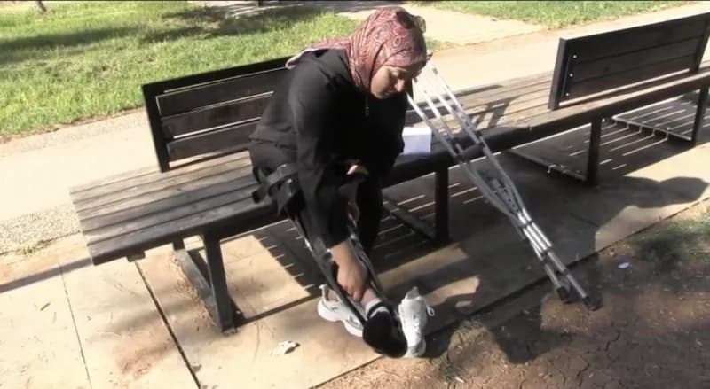 Diyarbakır'da 2014 yılında diz ağrısı şikayetiyle gittiği hastanede geçirdiği ameliyat sonrası bacağı dışa dönen ve haya