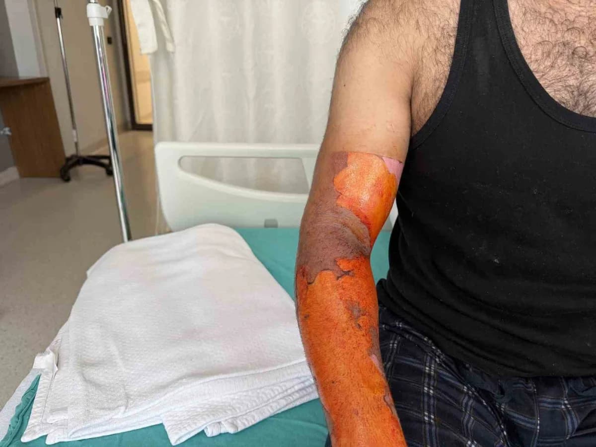Şoförlük yapan adam iddiaya göre Şehir dışına işe gittiği aracın aküsü patlayınca alevlerin arasında kaldı.