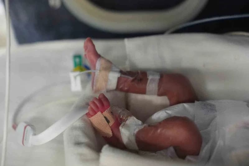 Gebeliğin 24. Haftasında 720 gram ağırlığında dünyaya gelen Bahar bebek, tedavi sürecinde 600 grama kadar düşmesine rağm