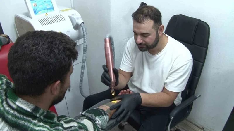 Özellikle çiftlerin sevgili oldukları dönemde yaptırdıkları dövmeleri, ayrılık sonrası pişmanlık yaşayarak sildirmek ist