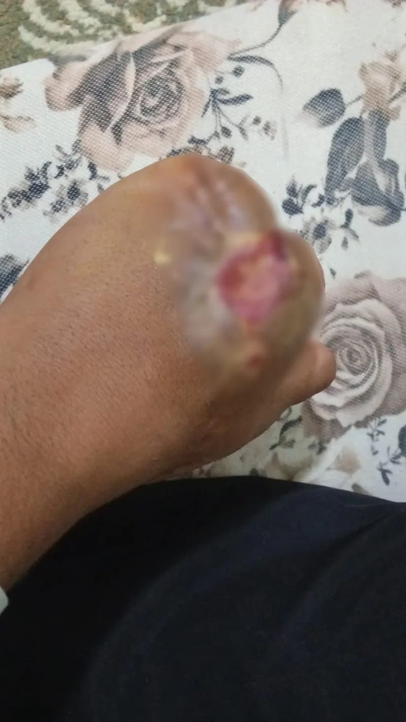 5 parmağını kaybetti, parmak başına 100 bin lira teklif edildi
