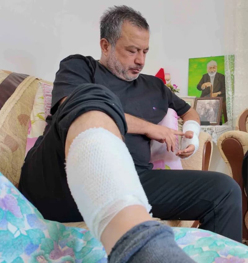 Şükrü Erdoğan köpek saldırısında yaralandı