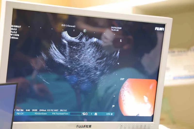 Gastroenteroloji Cerrahisi Uzmanı Doç. Dr. Bahtiyar Muhammedoğlu, pankreas kanseri ve safra yolu hastalıklarının tanı ve