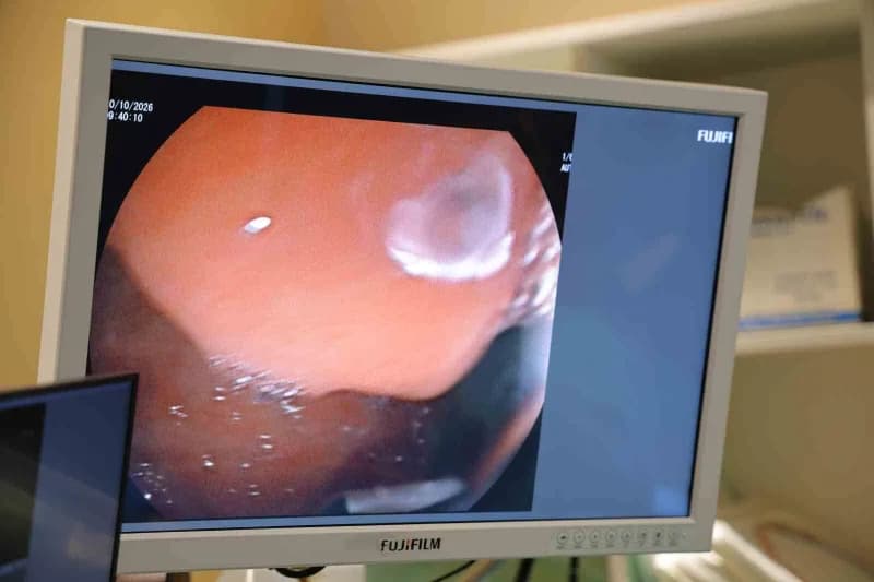 HG Hospital'da görev yapan Doç. Dr. Muhammedoğlu, özellikle pankreas kanseri ve periampuller bölge tümörlerinin değerlen