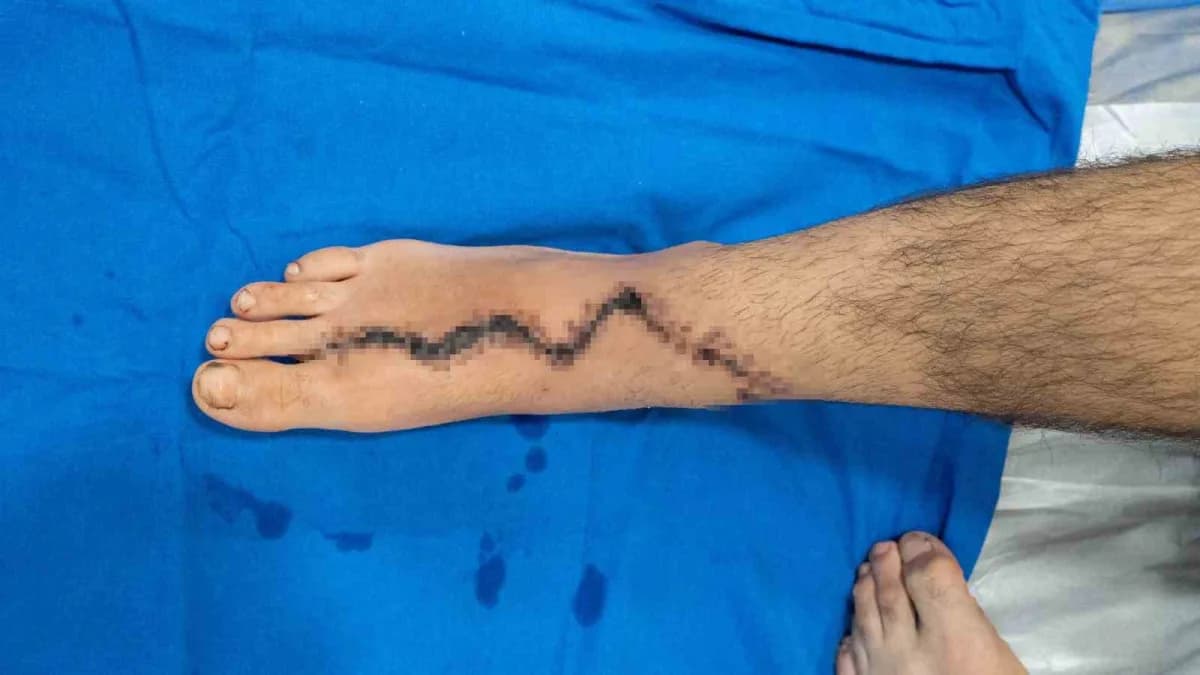 İstanbul'da yaşayan 13 yaşındaki Baran Tanzi, iddiaya göre bir kasabın yanında çırak olarak çalışırk