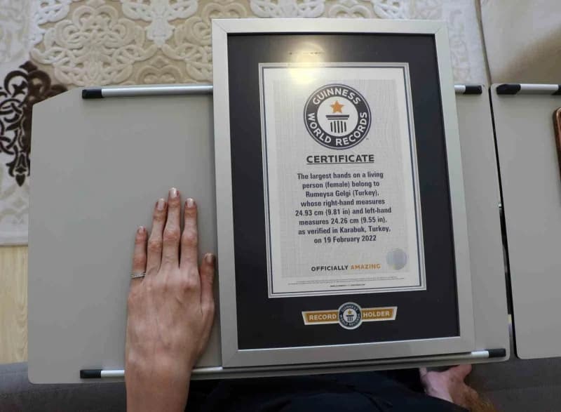İlk kez 2014 yılında 2 metre 13 santimetrelik boyuyla "Dünyanın 18 yaş altı en uzun genç kızı" ünvan