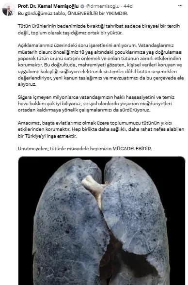 Sağlıksız akciğer görüntüsü ve Sağlık Bakanı Kemal Memişoğlu'nun tütün ürünlerinin zararlarına dair açıklaması